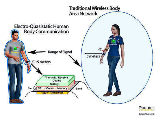 This Watch Like Device Protects Pacemakers From Hackers