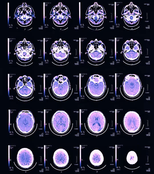 numerous brain scans