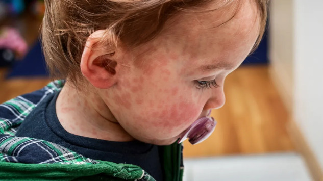 A child holding food while a parent checks for allergens, highlighting the importance of managing food allergies in children.