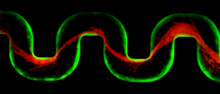 Biofilm Streamers Clog Medical Devices