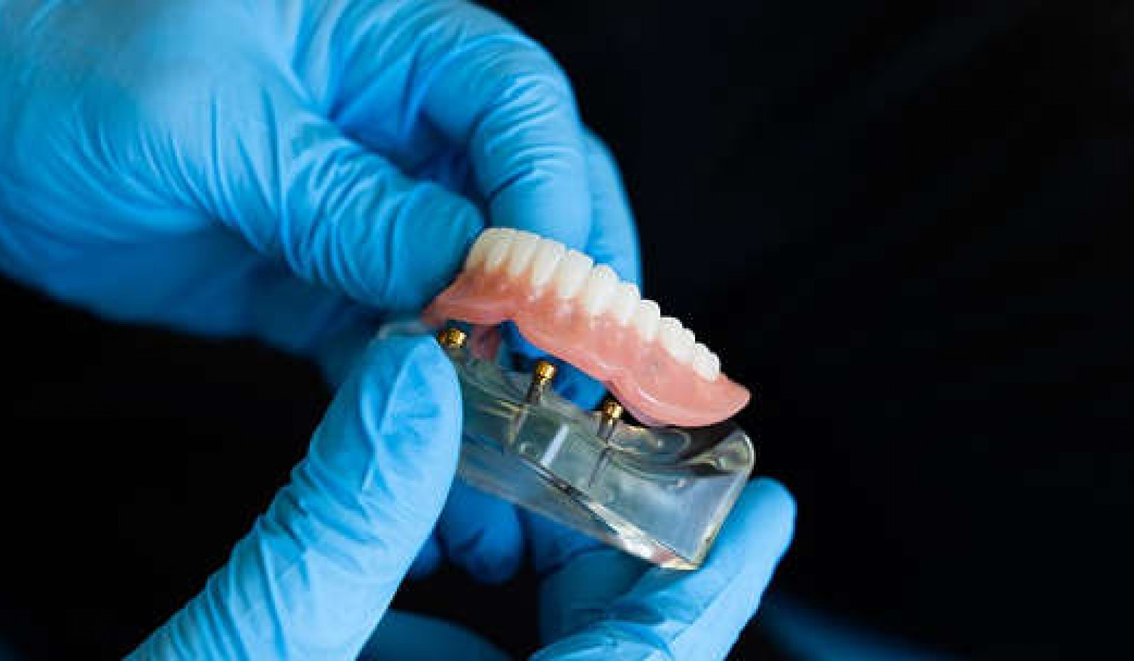 Can dentures help prevent dementia?